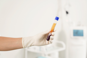 plasma ricco di piastrine