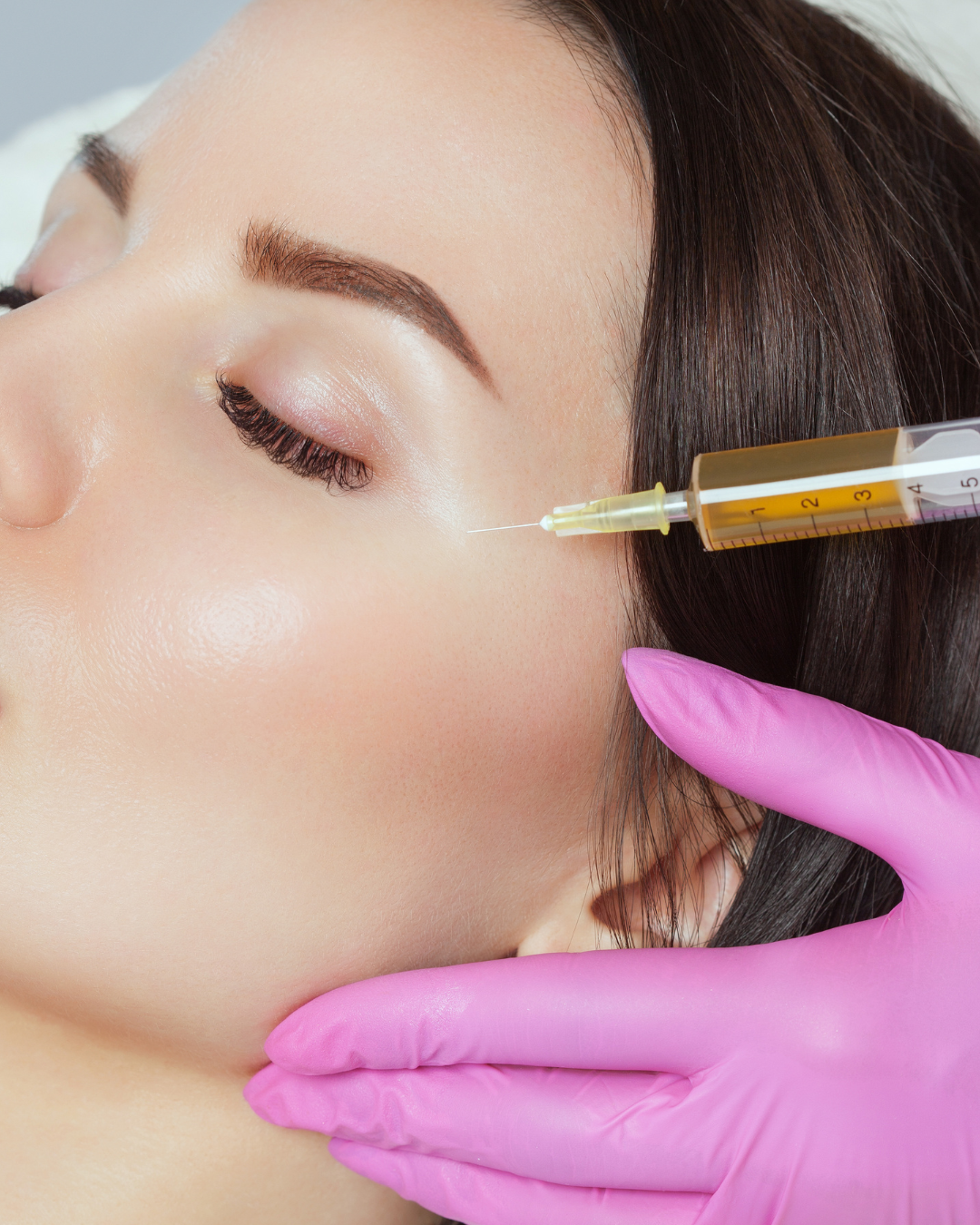 prp estetica